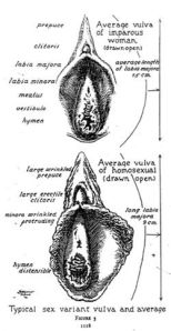 sexual-variance-in-vulva